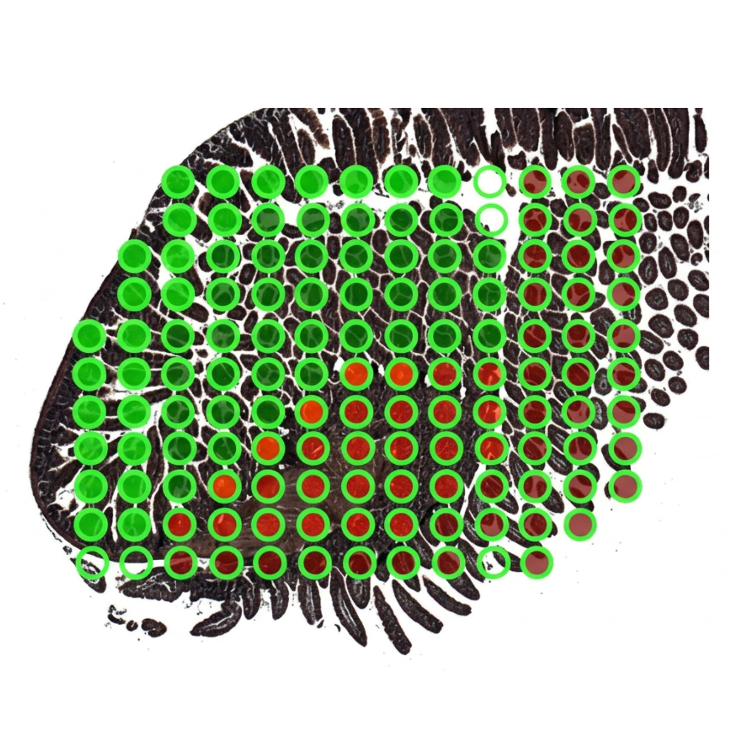 Spatial Transcriptomics