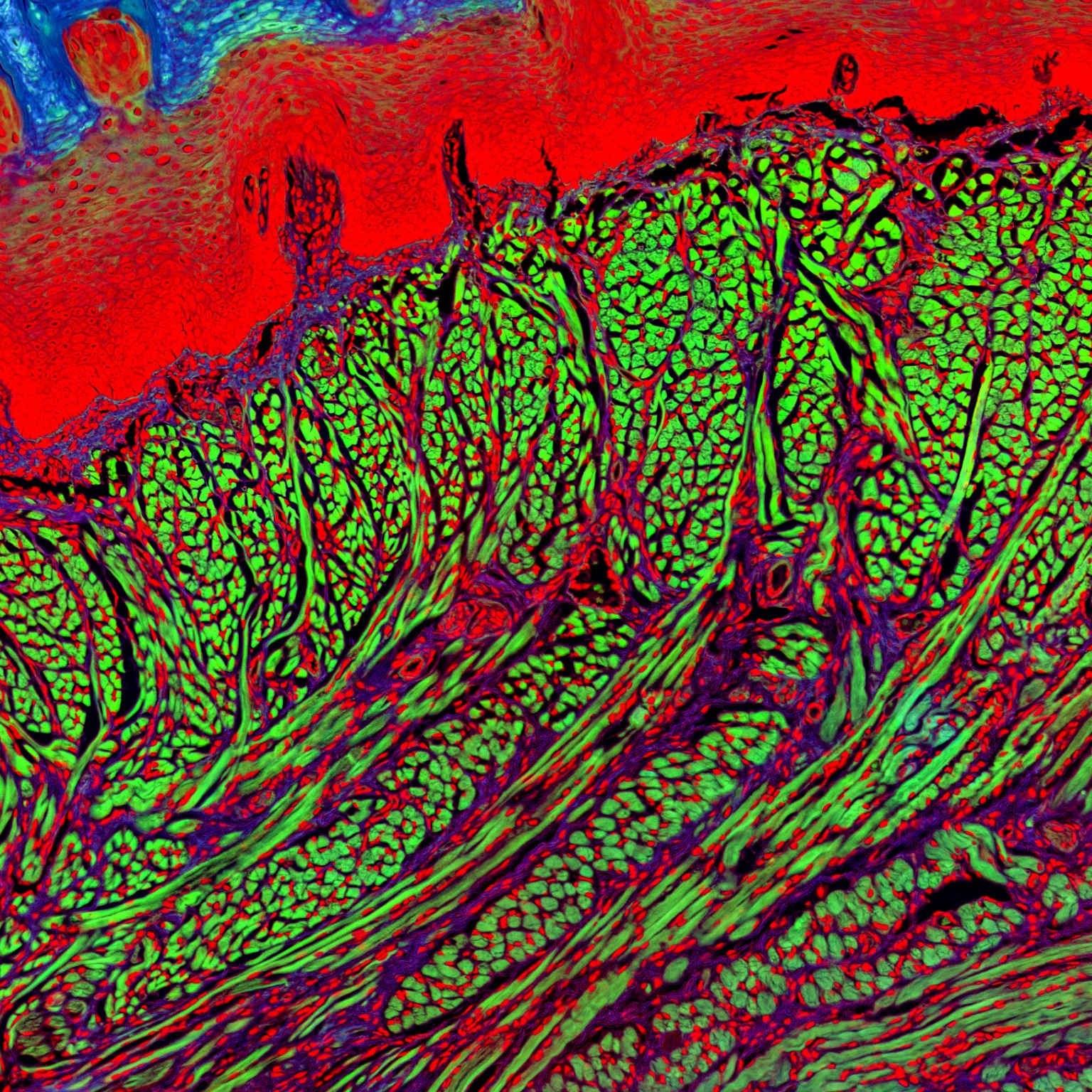 Multi-Fluorescence Imaging