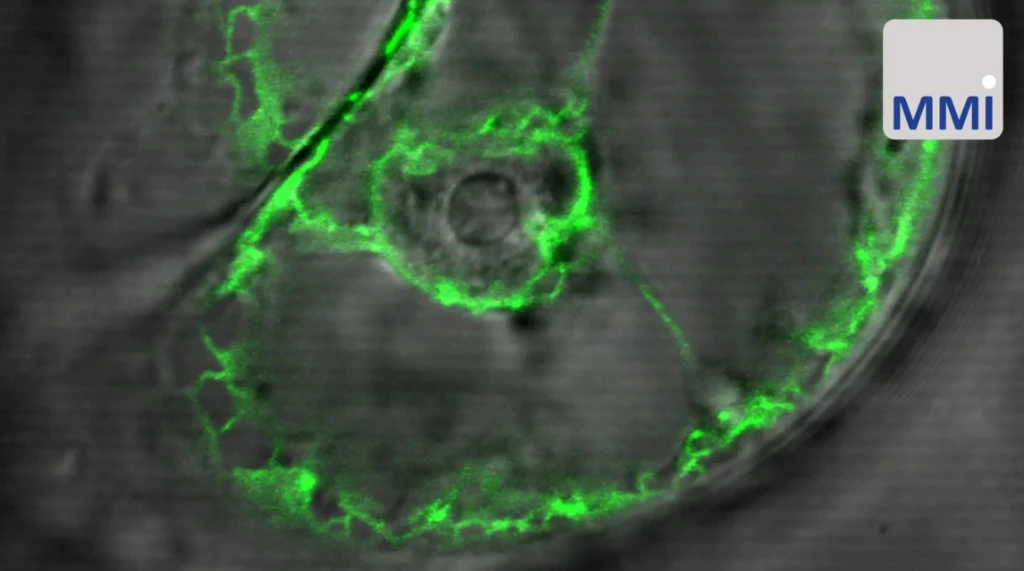 formation-of-cytoplasmic-protrusions.mp4