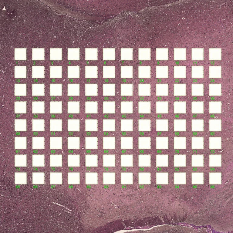 Isolation in 96 well plate