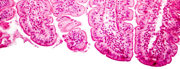 Villi of small intestine, magnification 100x